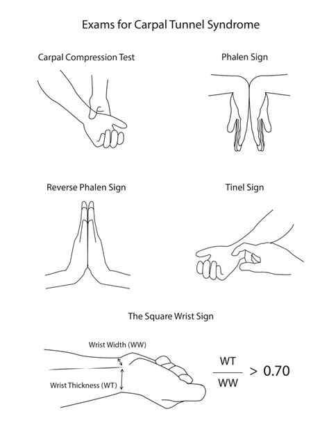 carpal tunnel test maneuvers